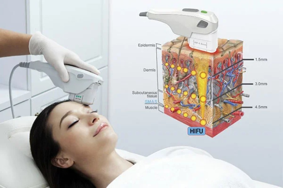 cong-nghe-hifu-2