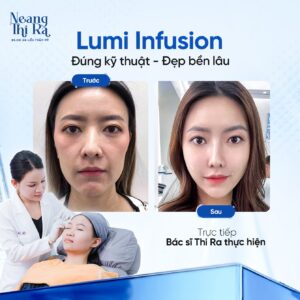 Lumiinfusion1